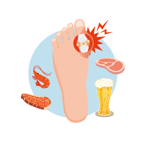 types-of-arthritis-infographic-gout